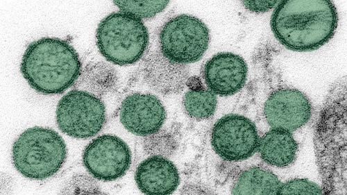 Information about the Hantavirus Outbreak